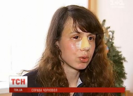 Татьяна Чорновол рассказала подробности жестокого избиения (ВИДЕО)