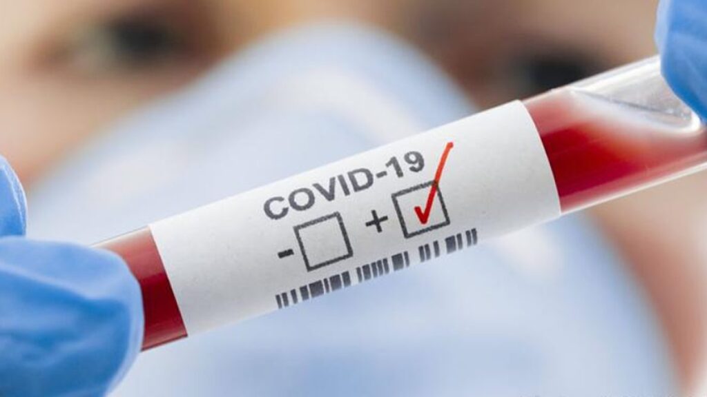 COVID-19 на Дніпропетровщині: кількість випадків перевищила 11 тисяч