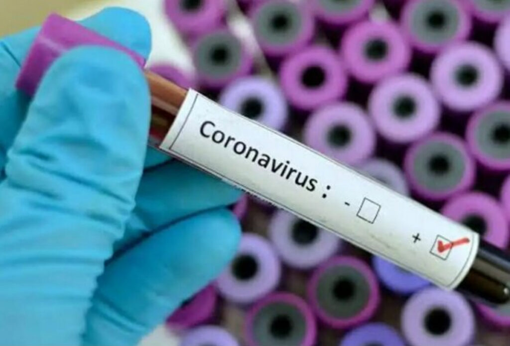 COVID-19 в Україні: 2.723 людини захворіли
