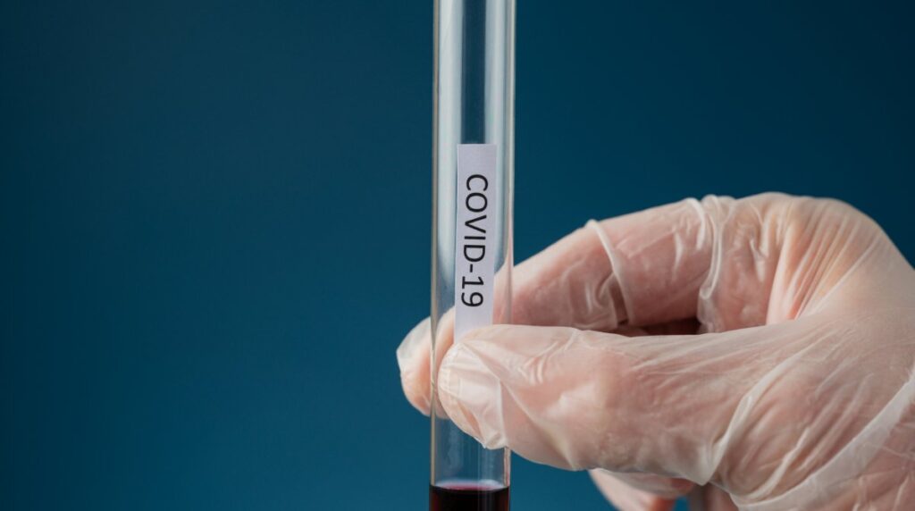 Мер Підгороднього захворів на COVID-19