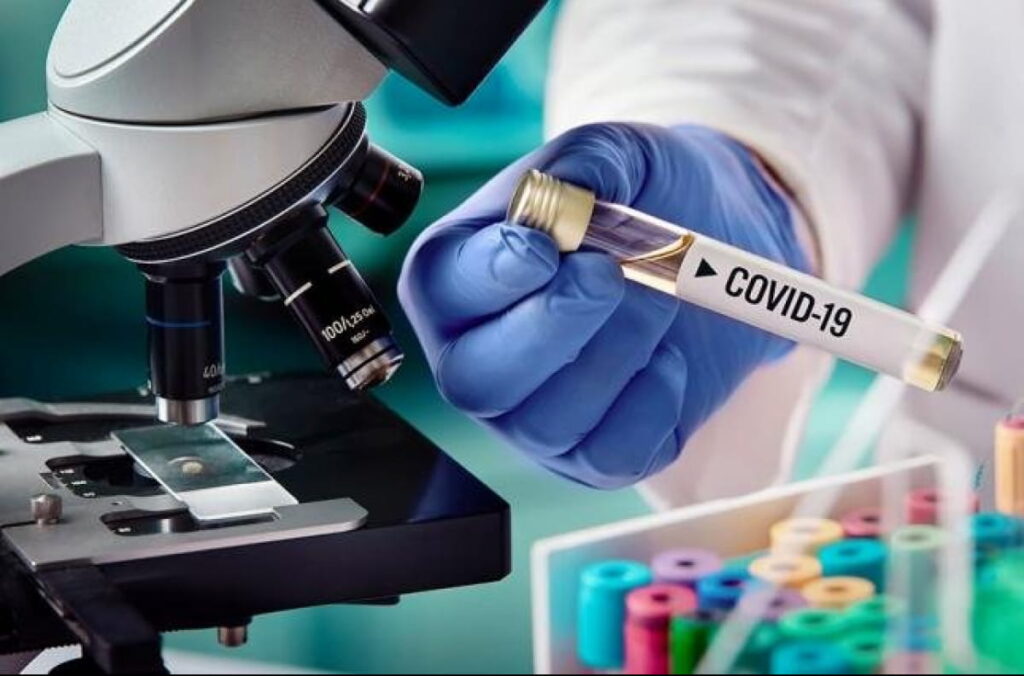 У 8 працівників ТОВ «Дніпрогаз» виявлено COVID-19