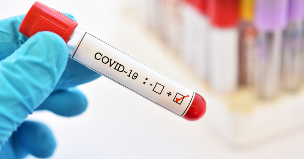 Дніпропетровщина — лідер за кількістю активних заражених COVID-19