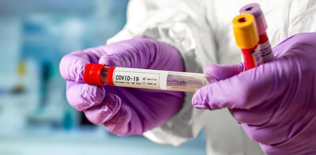 За добу COVID-19 виявили у 227 мешканців Дніпропетровщини