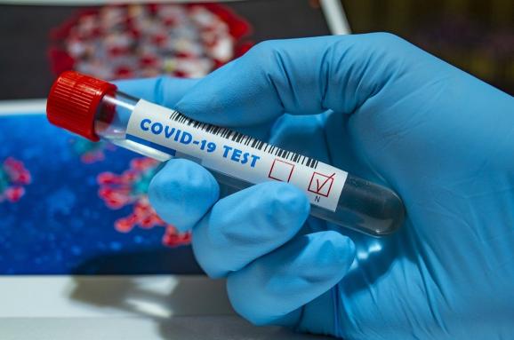 За добу на Дніпропетровщині зафіксували 1344 нові випадки COVID-19