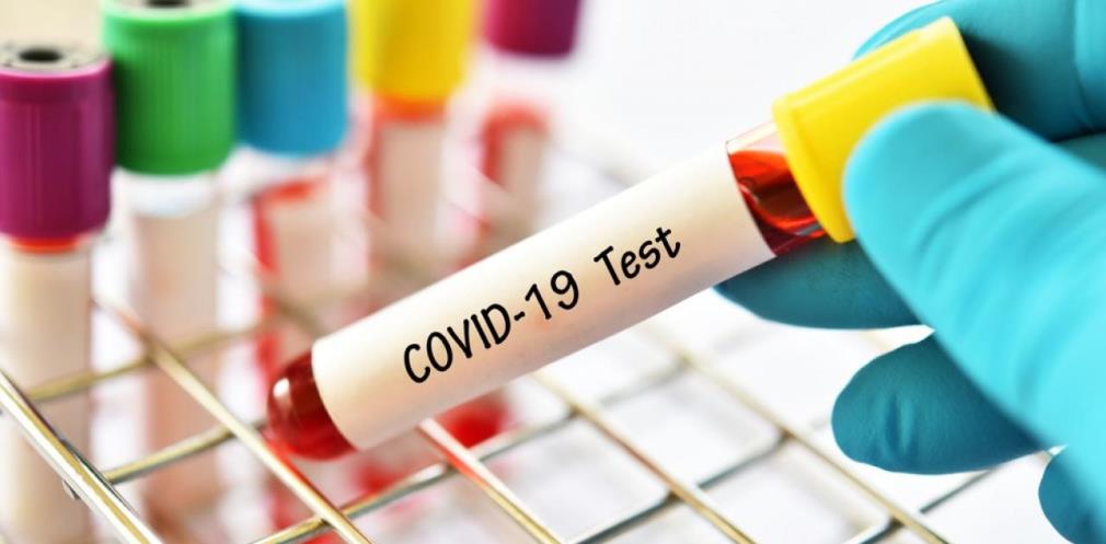 На Дніпропетровщині ще 1689 мешканців подолали COVID-19