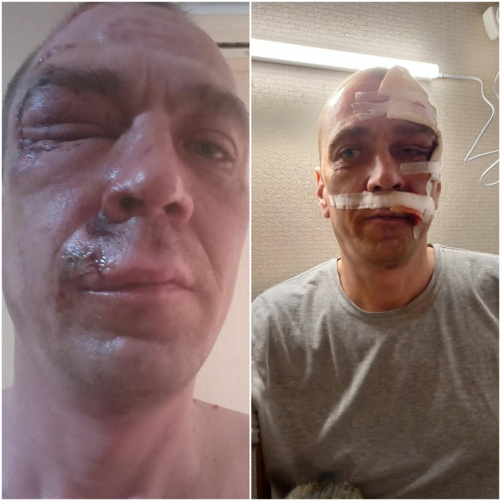 Кікбоксер розбив обличчя дніпрянину через припарковане в його дворі авто