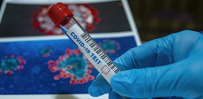 133 мешканця Дніпропетровщини одужали, 47 – захворіли: статистика COVID-19 за добу