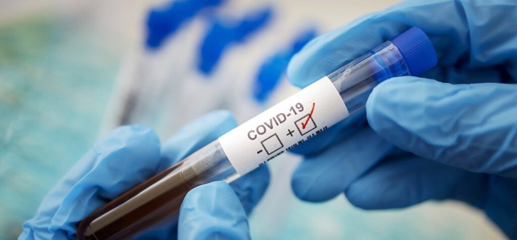 Статистика COVID-19 за добу: 75 мешканців Дніпропетровщини одужали, 36 – захворіли