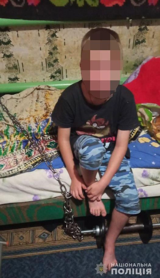 У Кривому Розі чоловік тримав на ланцюгу 7-річного хлопчика