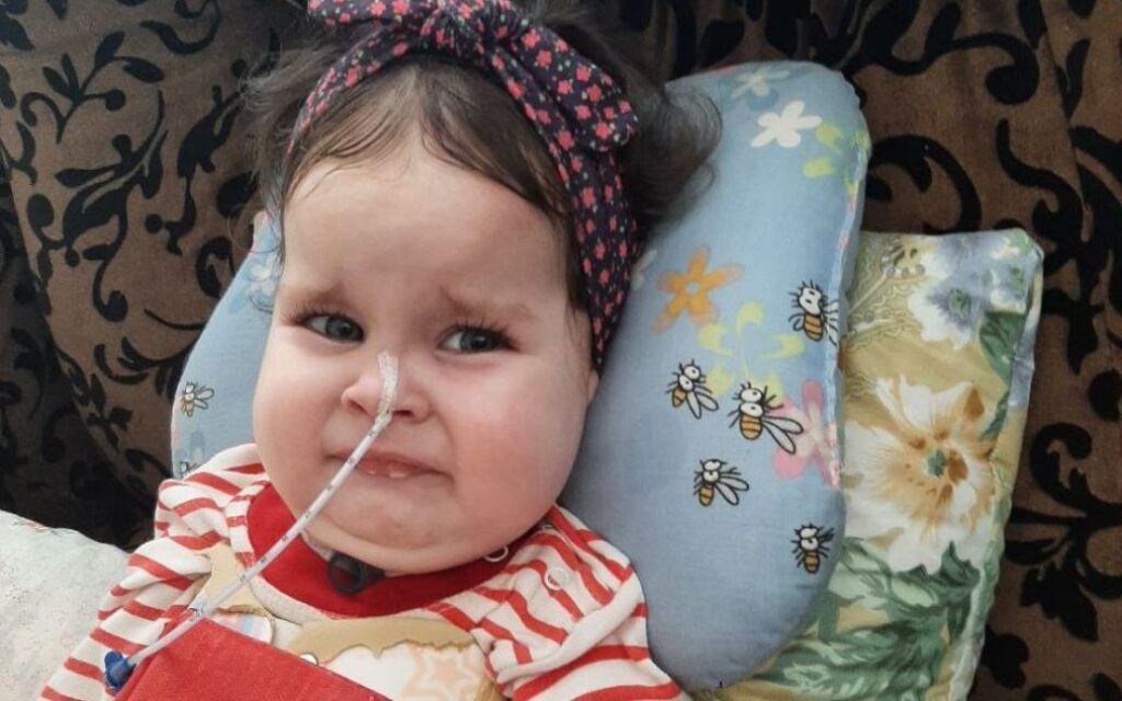 Життя ціною у 2 млн євро: на Дніпропетровщині рятують 1,5-річну Катрусю зі смертельною хворобою